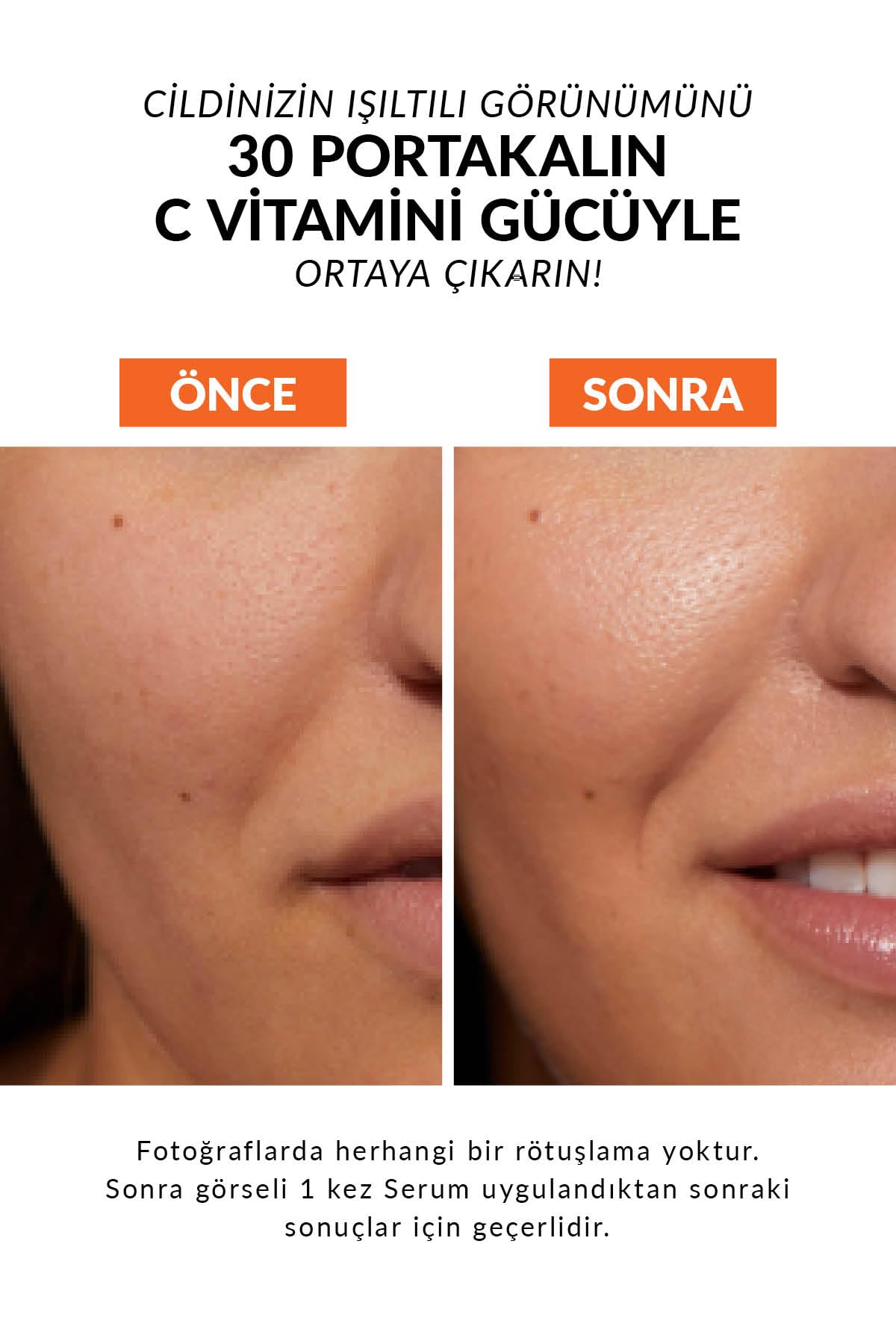 Avon Anew Radiance Maximising Vitamin C Serum, 30ml Boxed & Sealed, Brightens Tired Skin