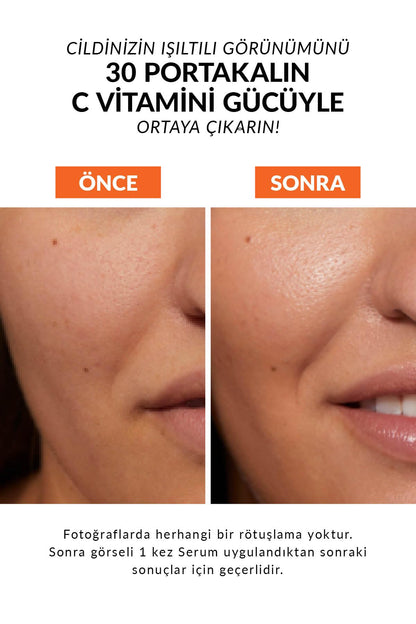 Avon Anew Radiance Maximising Vitamin C Serum, 30ml Boxed & Sealed, Brightens Tired Skin